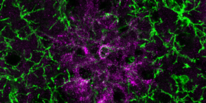 Dandelion clock-like rosette of chondroitin sulfate proteoglycans in the extracellular matrix, produced by oligodendrocyte progenitor cells in the somatosensory cortex of a 3- to 4-month-old-mouse.